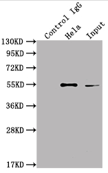Immunoprecipitating ILK in Hela whole cell lysate Lane 1: Rabbit control IgG instead of CSB-RA963626A0HU in Hela whole cell lysate. For western blotting,a HRP-conjugated Protein G antibody was used as the secondary antibody (1/2000) Lane 2: CSB-RA963626A0HU(2microg)+ Hela whole cell lysate(500microg) Lane 3: Hela whole cell lysate (10microg)