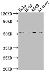 Western Blot Positive WB detected in: Hela whole cell lysate, HL60 whole cell lysate, A549 whole cell lysate, Mouse kidney tissue All lanes: ILK antibody at 1:2000 Secondary Goat polyclonal to rabbit IgG at 1/50000 dilution Predicted band size: 52, 45, 37 kDa Observed band size: 51 kDa Western Blot Positive WB detected in: Hela whole cell lysate, HL60 whole cell lysate, A549 whole cell lysate, Mouse kidney tissue All lanes: ILK antibody at 1:2000 Secondary Goat polyclonal to rabbit IgG at 1/50000 dilution Predicted band size: 52, 45, 37 kDa Observed band size: 51 kDa