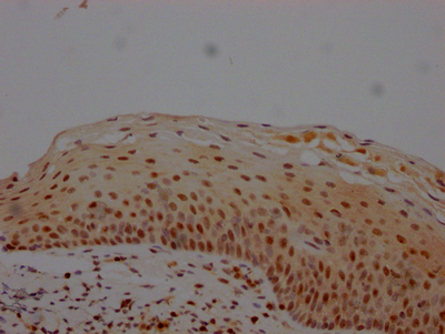 IHC image of CSB-RA966553A0HU diluted at 1:100 and staining in paraffin-embedded human tonsil tissue performed on a Leica BondTM system. After dewaxing and hydration, antigen retrieval was mediated by high pressure in a citrate buffer (pH 6.0). Section was blocked with 10% normal goat serum 30min at RT. Then primary antibody (1% BSA) was incubated at 4°C overnight. The primary is detected by a Goat anti-rabbit IgG polymer labeled by HRP and visualized using 0.05% DAB.