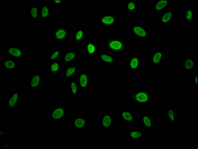 Immunofluorescence staining of Hela Cells with CSB-RA968740A0HU at 1:50, counter-stained with DAPI. The cells were fixed in 4% formaldehyde, permeated by 0.2% TritonX-100, and blocked in 10% normal Goat Serum. The cells were then incubated with the antibody overnight at 4°C. Nuclear DNA was labeled in blue with DAPI. The secondary antibody was FITC-conjugated AffiniPure Goat Anti-Rabbit IgG (H+L).