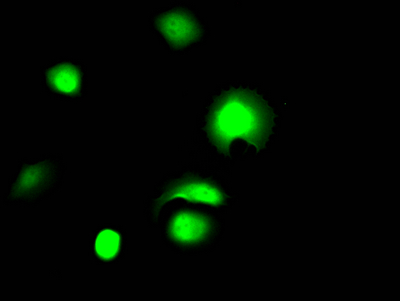 Immunofluorescence staining of MCF7 Cells with CSB-RA970289A0HU at 1:50, counter-stained with DAPI. The cells were fixed in 4% formaldehyde, permeated by 0.2% TritonX-100, and blocked in 10% normal Goat Serum. The cells were then incubated with the antibody overnight at 4°C. Nuclear DNA was labeled in blue with DAPI. The secondary antibody was FITC-conjugated AffiniPure Goat Anti-Rabbit IgG (H+L).