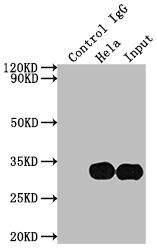 Immunoprecipitating LGALS3 in Hela whole cell lysate Lane 1: Rabbit control IgG instead of CSB-RA970289A0HU in Hela whole cell lysate. For western blotting,a HRP-conjugated Protein G antibody was used as the secondary antibody (1/2000) Lane 2: CSB-RA970289A0HU(2microg)+ Hela whole cell lysate(500microg) Lane 3: Hela whole cell lysate (10microg)