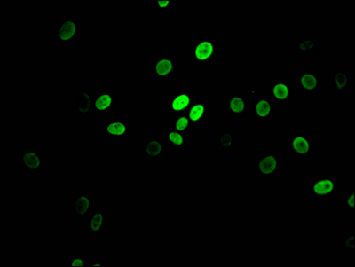 Immunofluorescence staining of HepG2 Cells with CSB-RA978157A0HU at 1:50, counter-stained with DAPI. The cells were fixed in 4% formaldehyde, permeated by 0.2% TritonX-100, and blocked in 10% normal Goat Serum. The cells were then incubated with the antibody overnight at 4°C. Nuclear DNA was labeled in blue with DAPI. The secondary antibody was FITC-conjugated AffiniPure Goat Anti-Rabbit IgG (H+L).