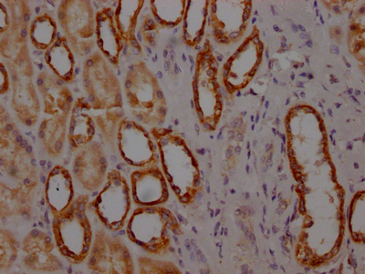 IHC image of CSB-RA978157A0HU diluted at 1:100 and staining in paraffin-embedded human kidney tissue performed on a Leica BondTM system. After dewaxing and hydration, antigen retrieval was mediated by high pressure in a citrate buffer (pH 6.0). Section was blocked with 10% normal goat serum 30min at RT. Then primary antibody (1% BSA) was incubated at 4°C overnight. The primary is detected by a Goat anti-rabbit IgG polymer labeled by HRP and visualized using 0.05% DAB. IHC image of CSB-RA978157A0HU diluted at 1:100 and staining in paraffin-embedded human kidney tissue performed on a Leica BondTM system. After dewaxing and hydration, antigen retrieval was mediated by high pressure in a citrate buffer (pH 6.0). Section was blocked with 10% normal goat serum 30min at RT. Then primary antibody (1% BSA) was incubated at 4°C overnight. The primary is detected by a Goat anti-rabbit IgG polymer labeled by HRP and visualized using 0.05% DAB.