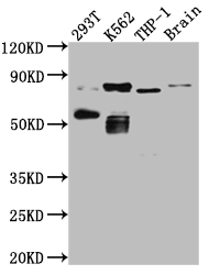 Western Blot Positive WB detected in: 293T whole cell lysate, K562 whole cell lysate, THP-1 whole cell lysate, Mouse Brain whole cell lysate All lanes: PKC antibody at 1:1000 Secondary Goat polyclonal to rabbit IgG at 1/50000 dilution Predicted band size: 82, 75, 68 kDa Observed band size: 82, 55 kDa Western Blot Positive WB detected in: 293T whole cell lysate, K562 whole cell lysate, THP-1 whole cell lysate, Mouse Brain whole cell lysate All lanes: PKC antibody at 1:1000 Secondary Goat polyclonal to rabbit IgG at 1/50000 dilution Predicted band size: 82, 75, 68 kDa Observed band size: 82, 55 kDa