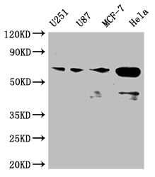 Western Blot Positive WB detected in: U251 whole cell lysate, U87 whole cell lysate, MCF-7 whole cell lysate, Hela whole cell lysate All lanes: STK3 antibody at 1:2000 Secondary Goat polyclonal to rabbit IgG at 1/50000 dilution Predicted band size: 57, 60 kDa Observed band size: 50-70 kDa Western Blot Positive WB detected in: U251 whole cell lysate, U87 whole cell lysate, MCF-7 whole cell lysate, Hela whole cell lysate All lanes: STK3 antibody at 1:2000 Secondary Goat polyclonal to rabbit IgG at 1/50000 dilution Predicted band size: 57, 60 kDa Observed band size: 50-70 kDa