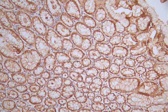 MAPK1/MAPK3 Recombinant Monoclonal Antibody - image 2