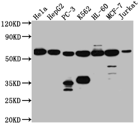 Western Blot Positive WB detected in: Hela whole cell lysate, HepG2 whole cell lysate, PC-3 whole cell lysate, K562 whole cell lysate, HL-60 whole cell lysate, MCF-7 whole cell lysate, Jurkat whole cell lysate All lanes: PTBP1 antibody at 1:1000 Secondary Goat polyclonal to rabbit IgG at 1/50000 dilution Predicted band size: 58, 60, 60 kDa Observed band size: 58 kDa Western Blot Positive WB detected in: Hela whole cell lysate, HepG2 whole cell lysate, PC-3 whole cell lysate, K562 whole cell lysate, HL-60 whole cell lysate, MCF-7 whole cell lysate, Jurkat whole cell lysate All lanes: PTBP1 antibody at 1:1000 Secondary Goat polyclonal to rabbit IgG at 1/50000 dilution Predicted band size: 58, 60, 60 kDa Observed band size: 58 kDa