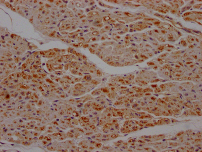 IHC image of CSB-RA987662A0HU diluted at 1:100 and staining in paraffin-embedded human heart tissue performed on a Leica BondTM system. After dewaxing and hydration, antigen retrieval was mediated by high pressure in a citrate buffer (pH 6.0). Section was blocked with 10% normal goat serum 30min at RT. Then primary antibody (1% BSA) was incubated at 4°C overnight. The primary is detected by a Goat anti-rabbit IgG polymer labeled by HRP and visualized using 0.05% DAB.