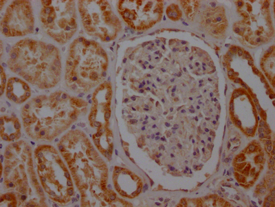 IHC image of CSB-RA987662A0HU diluted at 1:100 and staining in paraffin-embedded human kidney tissue performed on a Leica BondTM system. After dewaxing and hydration, antigen retrieval was mediated by high pressure in a citrate buffer (pH 6.0). Section was blocked with 10% normal goat serum 30min at RT. Then primary antibody (1% BSA) was incubated at 4°C overnight. The primary is detected by a Goat anti-rabbit IgG polymer labeled by HRP and visualized using 0.05% DAB.