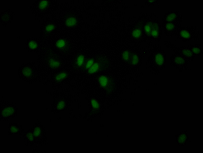 Immunofluorescence staining of MCF7 Cells with CSB-RA988421A0HU at 1:50, counter-stained with DAPI. The cells were fixed in 4% formaldehyde, permeated by 0.2% TritonX-100, and blocked in 10% normal Goat Serum. The cells were then incubated with the antibody overnight at 4°C. Nuclear DNA was labeled in blue with DAPI. The secondary antibody was FITC-conjugated AffiniPure Goat Anti-Rabbit IgG (H+L).