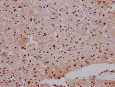 IHC image of CSB-RA990134A0HU diluted at 1:100 and staining in paraffin-embedded human heart tissue performed on a Leica BondTM system. After dewaxing and hydration, antigen retrieval was mediated by high pressure in a citrate buffer (pH 6.0). Section was blocked with 10% normal goat serum 30min at RT. Then primary antibody (1% BSA) was incubated at 4°C overnight. The primary is detected by a Goat anti-rabbit IgG polymer labeled by HRP and visualized using 0.05% DAB.