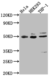 Western Blot Positive WB detected in: Hela whole cell lysate, HEK293 whole cell lysate, THP-1 whole cell lysate All lanes: MAPKAPK2 antibody at 1:1000 Secondary Goat polyclonal to rabbit IgG at 1/50000 dilution Predicted band size: 46, 43 kDa Observed band size: 49 kDa Western Blot Positive WB detected in: Hela whole cell lysate, HEK293 whole cell lysate, THP-1 whole cell lysate All lanes: MAPKAPK2 antibody at 1:1000 Secondary Goat polyclonal to rabbit IgG at 1/50000 dilution Predicted band size: 46, 43 kDa Observed band size: 49 kDa