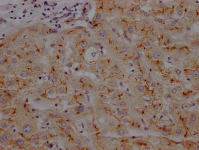 IHC image of CSB-RA993633A0HU diluted at 1:100 and staining in paraffin-embedded human liver tissue performed on a Leica BondTM system. After dewaxing and hydration, antigen retrieval was mediated by high pressure in a citrate buffer (pH 6.0). Section was blocked with 10% normal goat serum 30min at RT. Then primary antibody (1% BSA) was incubated at 4°C overnight. The primary is detected by a Goat anti-rabbit IgG polymer labeled by HRP and visualized using 0.05% DAB. IHC image of CSB-RA993633A0HU diluted at 1:100 and staining in paraffin-embedded human liver tissue performed on a Leica BondTM system. After dewaxing and hydration, antigen retrieval was mediated by high pressure in a citrate buffer (pH 6.0). Section was blocked with 10% normal goat serum 30min at RT. Then primary antibody (1% BSA) was incubated at 4°C overnight. The primary is detected by a Goat anti-rabbit IgG polymer labeled by HRP and visualized using 0.05% DAB.