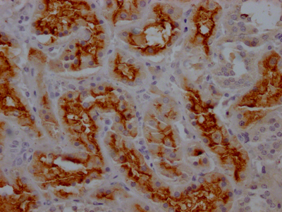 IHC image of CSB-RA993633A0HU diluted at 1:100 and staining in paraffin-embedded human kidney tissue performed on a Leica BondTM system. After dewaxing and hydration, antigen retrieval was mediated by high pressure in a citrate buffer (pH 6.0). Section was blocked with 10% normal goat serum 30min at RT. Then primary antibody (1% BSA) was incubated at 4°C overnight. The primary is detected by a Goat anti-rabbit IgG polymer labeled by HRP and visualized using 0.05% DAB.