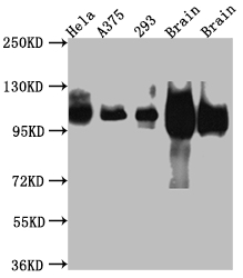 CSB-RA994273A0HU WB