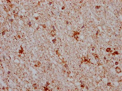 IHC image of CSB-RA999377A0HU diluted at 1:100 and staining in paraffin-embedded human brain tissue performed on a Leica BondTM system. After dewaxing and hydration, antigen retrieval was mediated by high pressure in a citrate buffer (pH 6.0). Section was blocked with 10% normal goat serum 30min at RT. Then primary antibody (1% BSA) was incubated at 4°C overnight. The primary is detected by a Goat anti-rabbit IgG polymer labeled by HRP and visualized using 0.05% DAB.