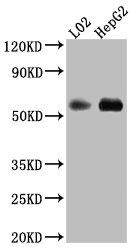 Western Blot Positive WB detected in: L02 whole cell lysate, HepG2 whole cell lysate All lanes: Monoamine Oxidase B Antibody at 1:1000 Secondary Goat polyclonal to rabbit IgG at 1/50000 dilution Predicted band size: 59, 47 kDa Observed band size: 59 kDa Western Blot Positive WB detected in: L02 whole cell lysate, HepG2 whole cell lysate All lanes: Monoamine Oxidase B Antibody at 1:1000 Secondary Goat polyclonal to rabbit IgG at 1/50000 dilution Predicted band size: 59, 47 kDa Observed band size: 59 kDa