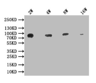Western Blot Positive WB detected in: 200ng recombinant protein with His tag His antibody at 1:2w, 1:4w, 1:8w, 1:16w, 1:32w, 1:64w Secondary Goat polyclonal to mouse IgG at 1/50000 dilution Predicted band size:62.5 KDa Observed band size: 66 KDa Exposure time : 5min