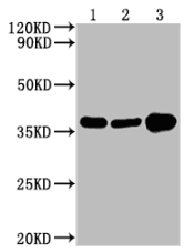 CSB-MA000071M0m Exosome kit 02