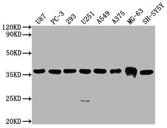 CSB-MA000071M1m WB