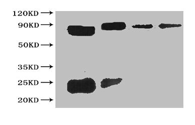 All Lanes The cell supernatant hybridoma of Sumo tag Lane 1 Sumo tagged fusion protein at 20ng Lane 2 Sumo tagged fusion protein at 2ng Lane 3 Sumo tagged fusion protein at 0.2ng Lane 4 Sumo tagged fusion protein at 0.02ng Secondary Goat polyclonal to Rabbit IgG at 1/15000 dilution Predicted band size : 50kd Observed band size: 50kd Additional bands at : 25 kd All Lanes The cell supernatant hybridoma of Sumo tag Lane 1 Sumo tagged fusion protein at 20ng Lane 2 Sumo tagged fusion protein at 2ng Lane 3 Sumo tagged fusion protein at 0.2ng Lane 4 Sumo tagged fusion protein at 0.02ng Secondary Goat polyclonal to Rabbit IgG at 1/15000 dilution Predicted band size : 50kd Observed band size: 50kd Additional bands at : 25 kd