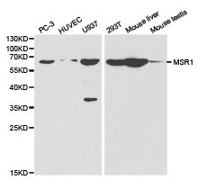 Western blot analysis of extracts of various cell lines, using MSR1 antibody. Western blot analysis of extracts of various cell lines, using MSR1 antibody.