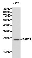 Western blot analysis of K562 cell lysate using RAB7A antibody. Western blot analysis of K562 cell lysate using RAB7A antibody.