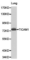 Western blot analysis of lung cell lysate using TICAM1 antibody. Western blot analysis of lung cell lysate using TICAM1 antibody.