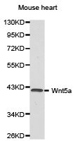 Western blot analysis of extracts of mouse heart cell lines, using Wnt5a antibody. Western blot analysis of extracts of mouse heart cell lines, using Wnt5a antibody.