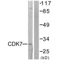 Western blot analysis of extracts from 293 cells, using CDK7 antibody.