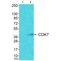 Western blot analysis of extracts from Colo cells using CDK7 antibody. The lane on the left is treated with synthesized peptide.