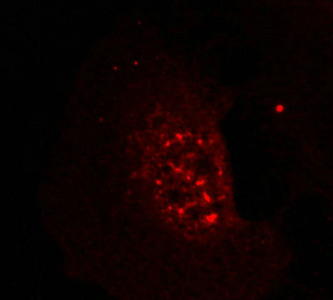 Immunofluorescence staining of methanol-fixed Hela cells showing nuclear dot staining using Akt(Phospho-Thr308) Antibody.