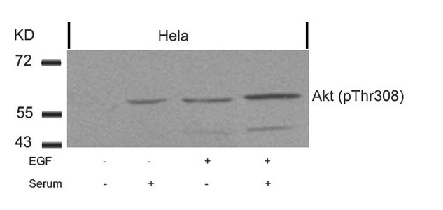 Western blot analysis of extracts from Hela cells untreated or treated with EGF, serum or both using Akt(Phospho-Thr308) Antibody. Western blot analysis of extracts from Hela cells untreated or treated with EGF, serum or both using Akt(Phospho-Thr308) Antibody.