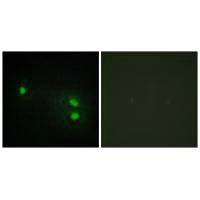 Immunofluorescence analysis of HeLa cells, using Histone H2B antibody.