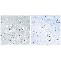 Immunohistochemistry analysis of paraffin-embedded human brain tissue using Histone H2B antibody.