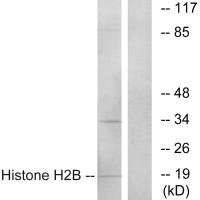 Western blot analysis of extracts from A549 cells, using Histone H2B antibody. Western blot analysis of extracts from A549 cells, using Histone H2B antibody.