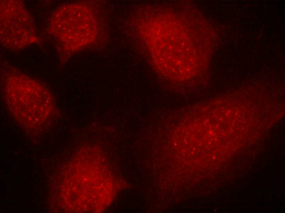 Immunofluorescence staining of methanol-fixed HeLa cells using CARM1(Ab-228) antibody.