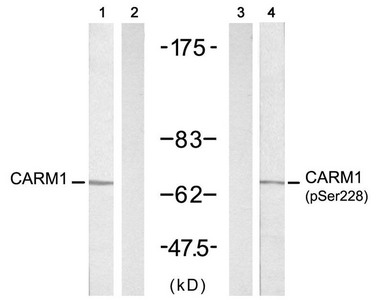 Western blot analysis of extracts from A431 cells untreated or treated with EGF(200ng/ml, 5min), using CARM1(Ab-228) antibody(, Line 1 and 2) and CARM1(Phospho-Ser228) antibody(, Line 3 and 4). Western blot analysis of extracts from A431 cells untreated or treated with EGF(200ng/ml, 5min), using CARM1(Ab-228) antibody(, Line 1 and 2) and CARM1(Phospho-Ser228) antibody(, Line 3 and 4).