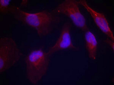 Immunofluorescence staining of methanol-fixed Hela cells using SEK1/MKK4(Phospho-Thr261) Antibody.