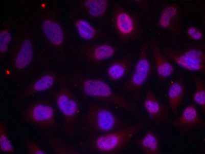 Immunofluorescence staining of methanol-fixed Hela cells using MEF2A(Phospho-Thr312) Antibody.