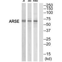Western blot analysis of extracts from K562/293/Jurkat cells, using ARSE antibody. Western blot analysis of extracts from K562/293/Jurkat cells, using ARSE antibody.