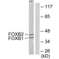 Western blot analysis of extracts from 293 cells, using FOXB1/2 antibody. Western blot analysis of extracts from 293 cells, using FOXB1/2 antibody.