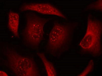 Immunofluorescence staining of methanol-fixed HeLa cells using FKHRL1 (phospho-Ser253) antibody.