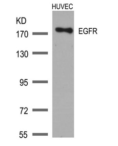 Western blot analysis of extracts from HUVEC cells using EGFR(Ab-1172) Antibody. Western blot analysis of extracts from HUVEC cells using EGFR(Ab-1172) Antibody.