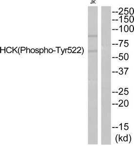 Western blot analysis of extracts from JurKat cells using HCK (Phospho-Tyr522) Antibody.The lane on the right is treated with the antigen-specific peptide. Western blot analysis of extracts from JurKat cells using HCK (Phospho-Tyr522) Antibody.The lane on the right is treated with the antigen-specific peptide.