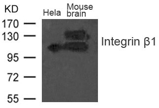 Western blot analysis of extract from Mouse brain tissue and Hela cells using Integrin b1(CD29) Antibody Western blot analysis of extract from Mouse brain tissue and Hela cells using Integrin b1(CD29) Antibody
