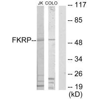 Western blot analysis of extracts from Jurkat cells and COLO205 cells, using FKRP antibody. Western blot analysis of extracts from Jurkat cells and COLO205 cells, using FKRP antibody.