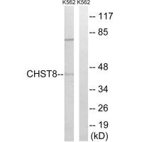 Western blot analysis of extracts from K562 cells, using CHST8 antibody. Western blot analysis of extracts from K562 cells, using CHST8 antibody.