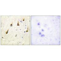 Immunohistochemistry analysis of paraffin-embedded human brain tissue using SENP7 antibody.